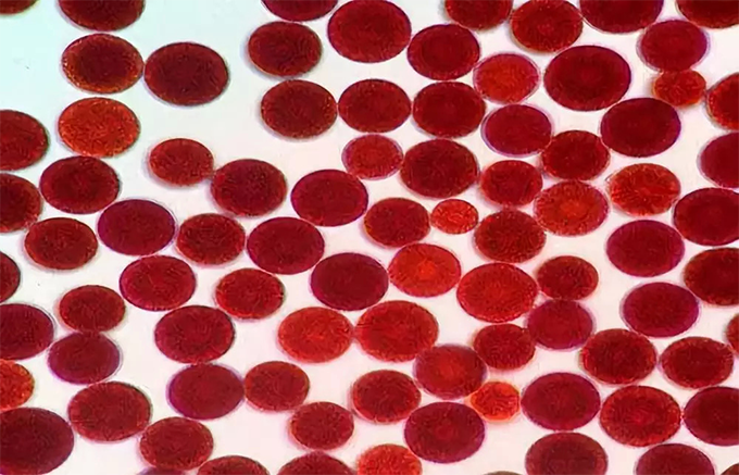 雨生红球藻(图4)